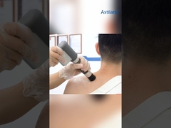 शॉकवेव + कंपन चिकित्सा मशीन